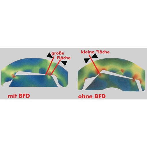 Berner Dugókulcs betétek