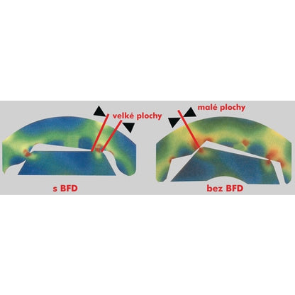 Berner Dugókulcs betétek